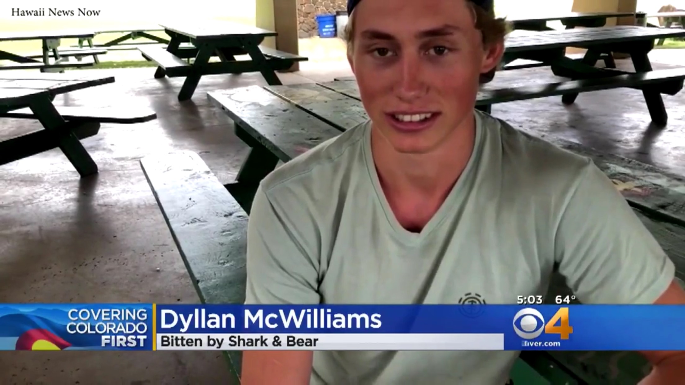 Dyllan McWilliams: Bitten By Shark and Bear
