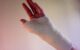 A hand and wrist in a plaster cast. (Photo by alysha naples via Flickr/Creative Commons https://flic.kr/p/4Ndp6i)