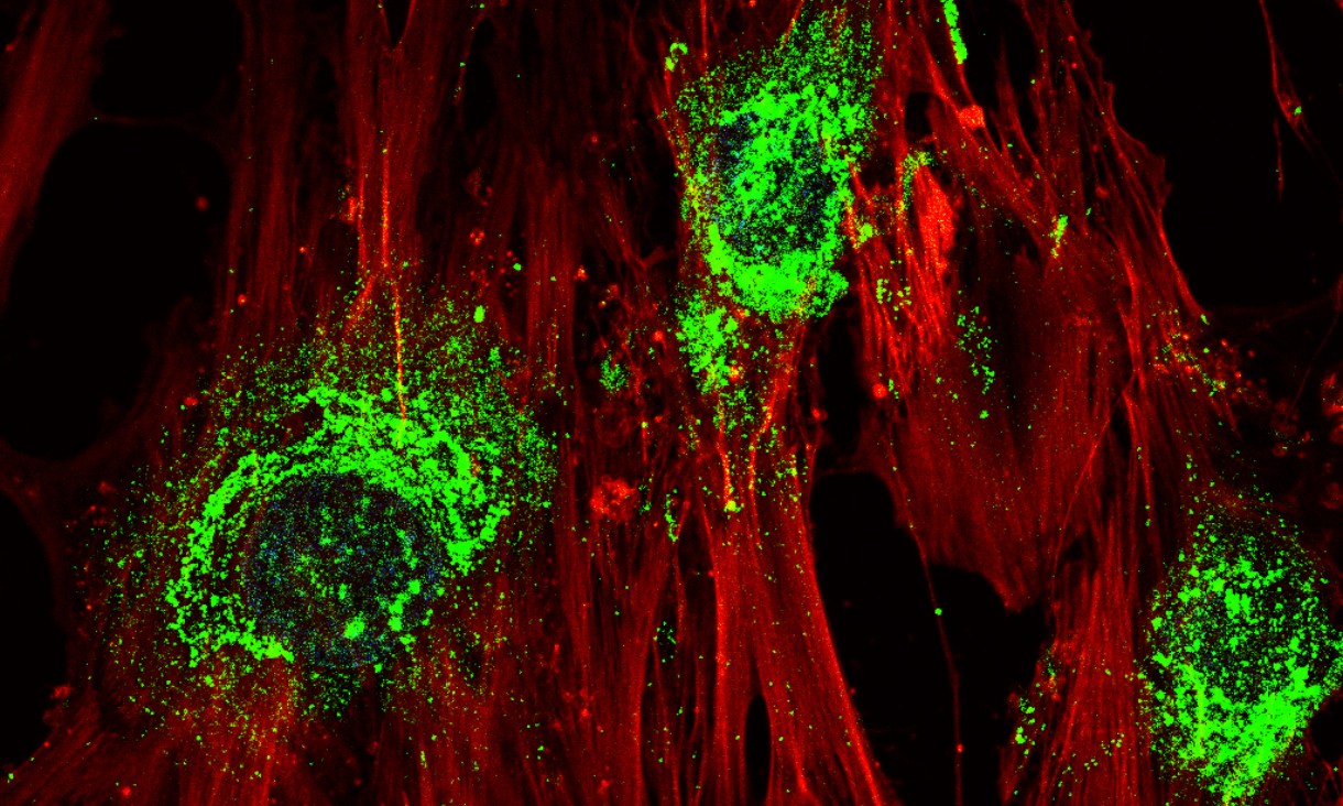 A magnified image showing adult stem cells in the process of turning into bone cells after treatment with high-frequency sound waves. Green colouring shows the presence of collagen, which the cells produce as they become bone cells. Magnification: 60X (Photo via RMIT https://www.rmit.edu.au/news/all-news/2022/feb/sound-waves-stem-cells)